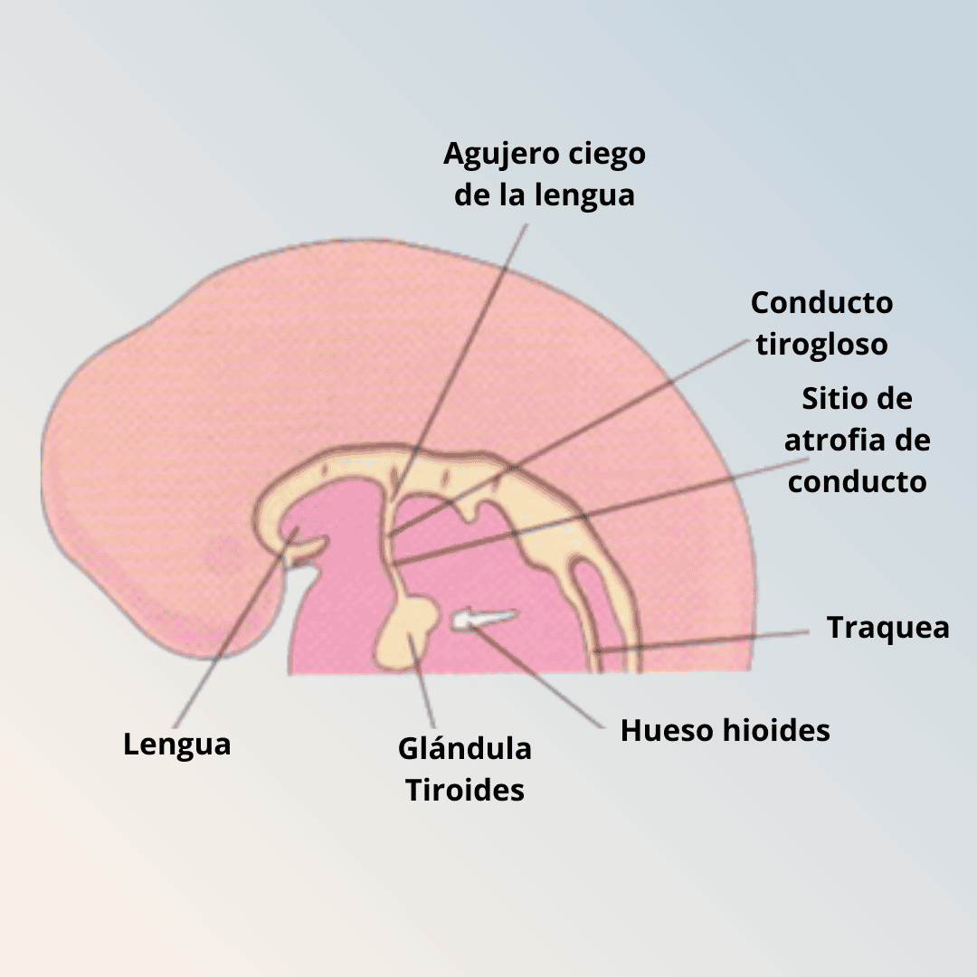 Autoinmune Tiroiditis