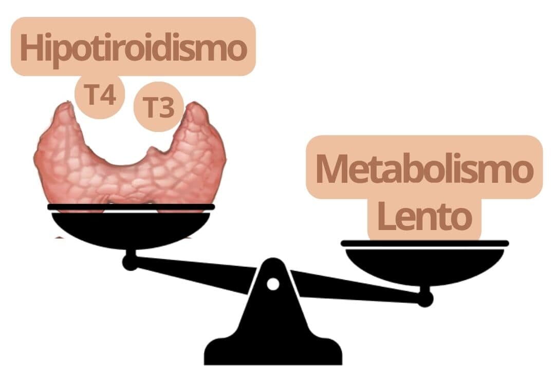 Autoinmune Tiroiditis