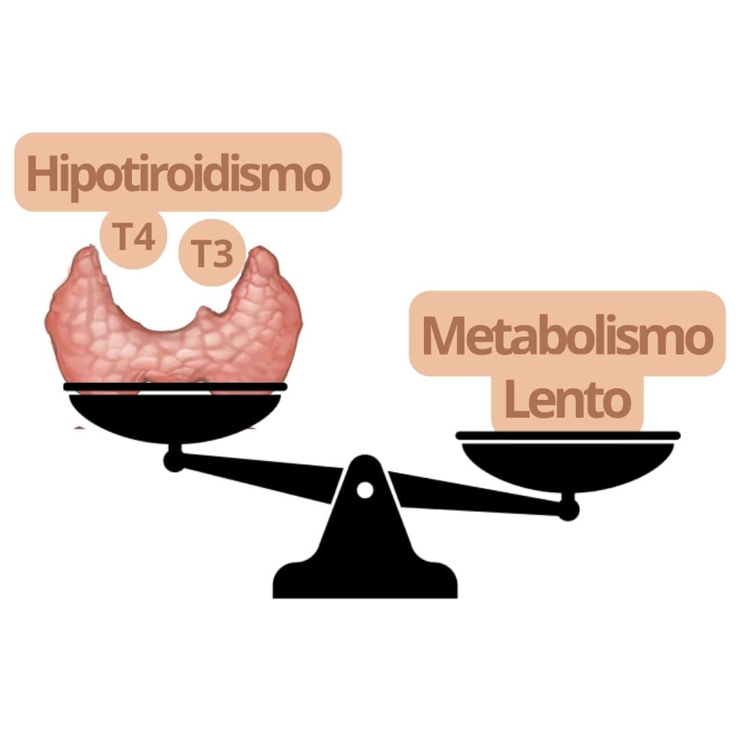 Autoinmune Tiroiditis
