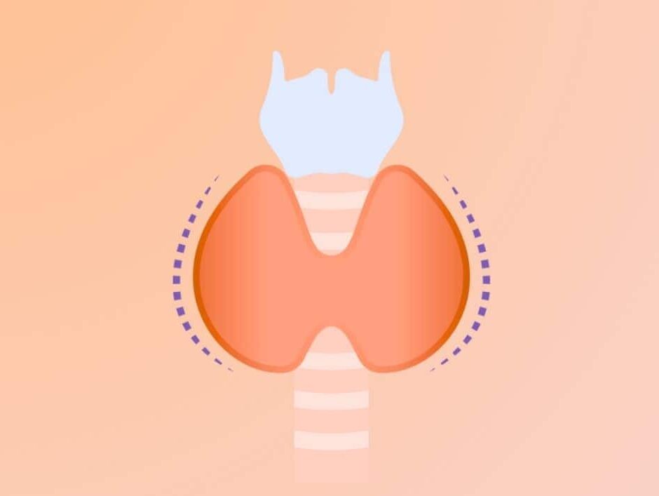 Autoinmune Tiroiditis